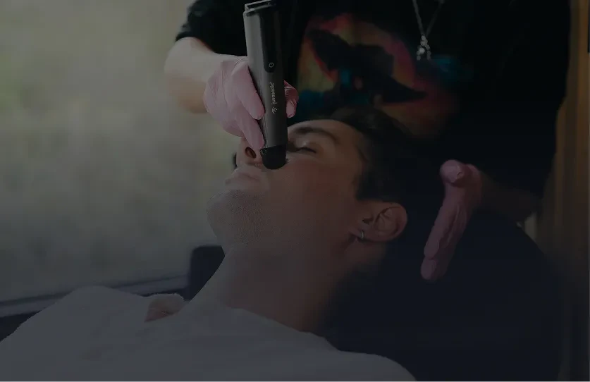 Klotho microchanneling treatment in progress