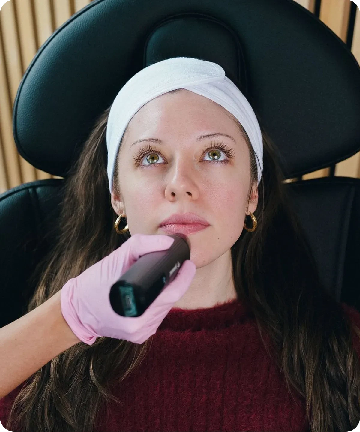 A clinician performing a Klotho microchanneling treatment